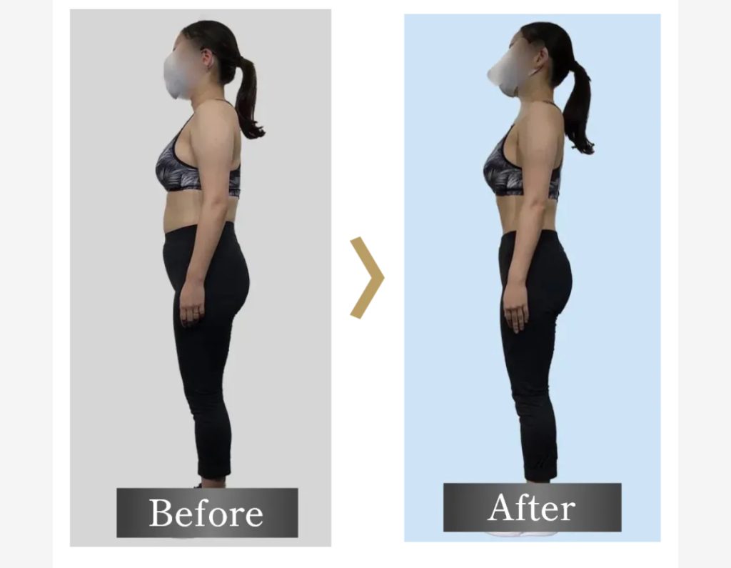 body_before_after_sample.jpg
