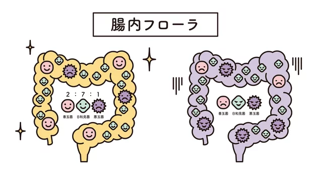腸内フローラのバランスが良い状態と乱れた状態の比較図