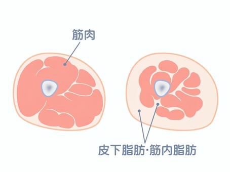 筋肉と皮下脂肪・筋肉内脂肪の比較図