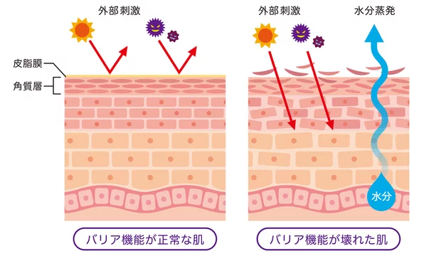 皮膚のバリア機能と外部刺激の侵入を説明した図解イラスト